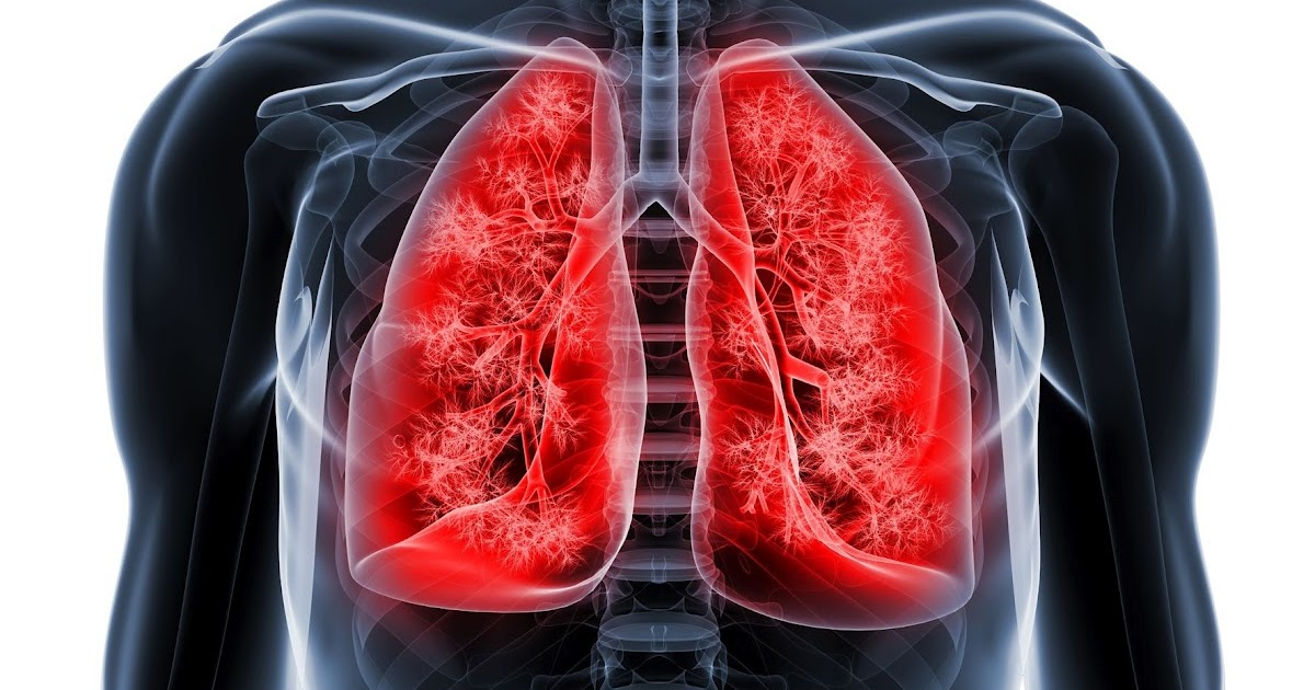 Lung Cancer Surgery Market