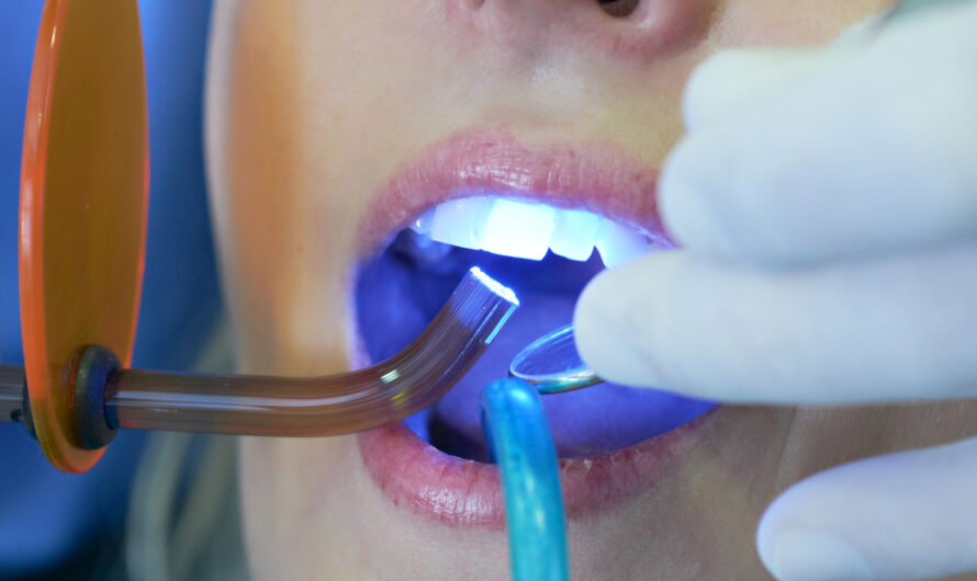 Dental Polymerization Lamps Market Is Estimated To Witness High Growth Owing To Technological Advancements