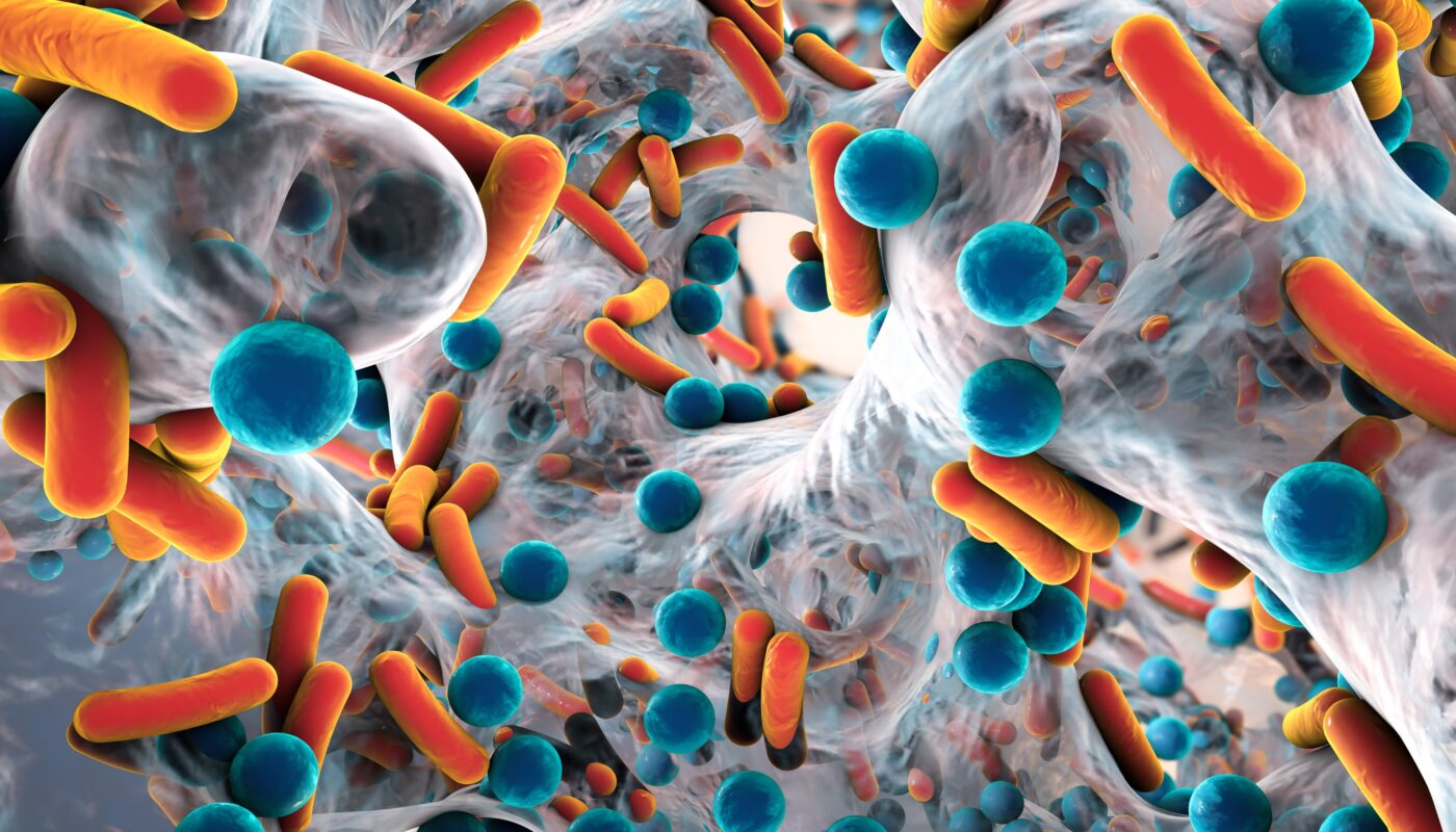 New Approaches to Treating Tuberculosis Preserve Respiratory Microbiome