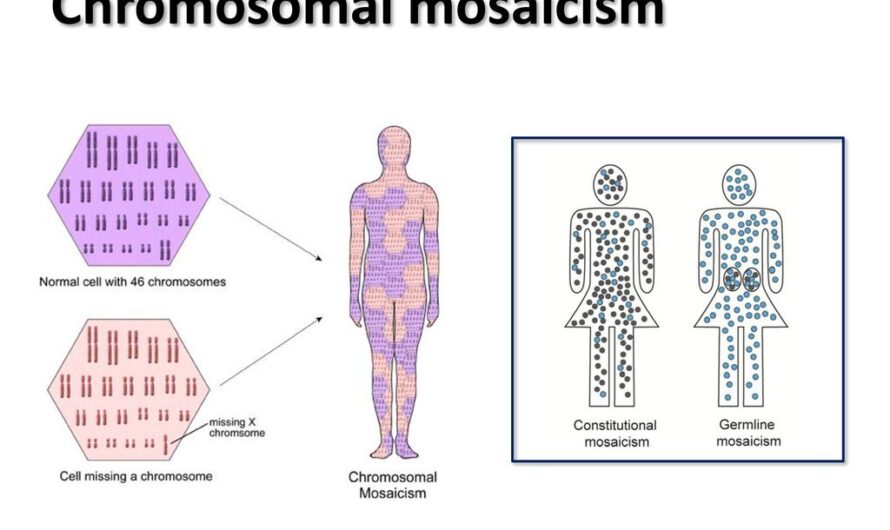 New Study Explores Mosaic Chromosomal Alterations and Cancer Risk
