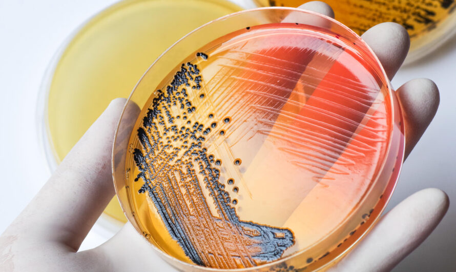 Safeguarding Public Health through Accelerated Salmonella Testing