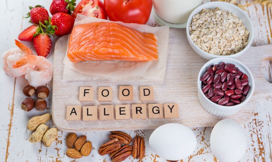 Rising Prevalence Of Food Allergies To Boost The Growth Of The Food Allergen Testing Market