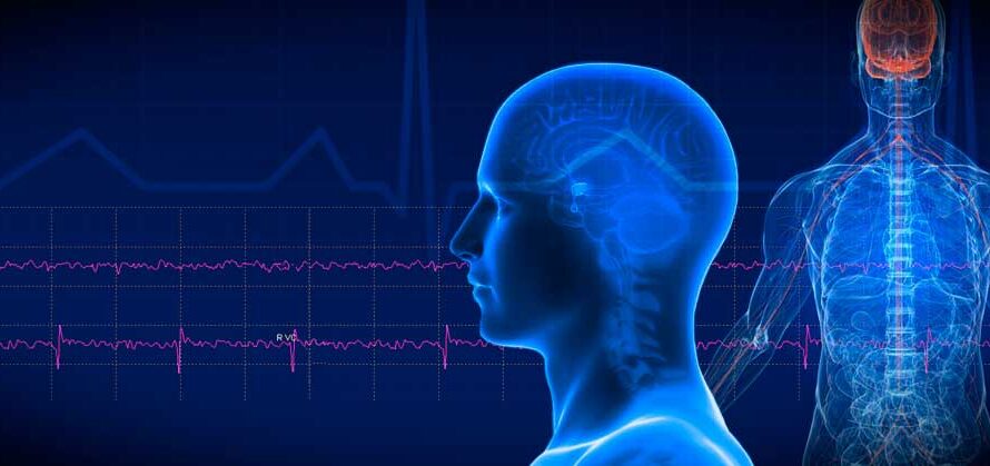 The Neurology Monitoring Market is Expected to be Flourished by Rising Demand for Wearable Technology