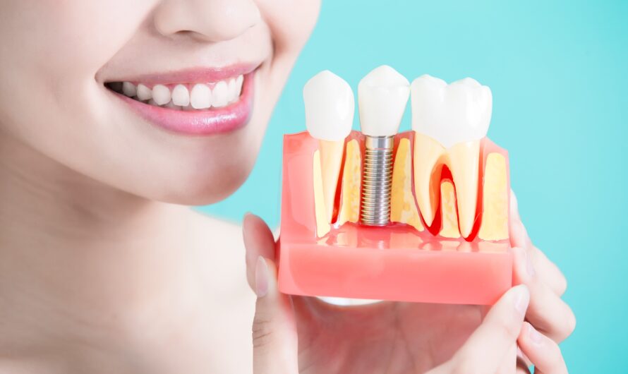 The Global Dental Implants Market Driven By Increasing Geriatric Population