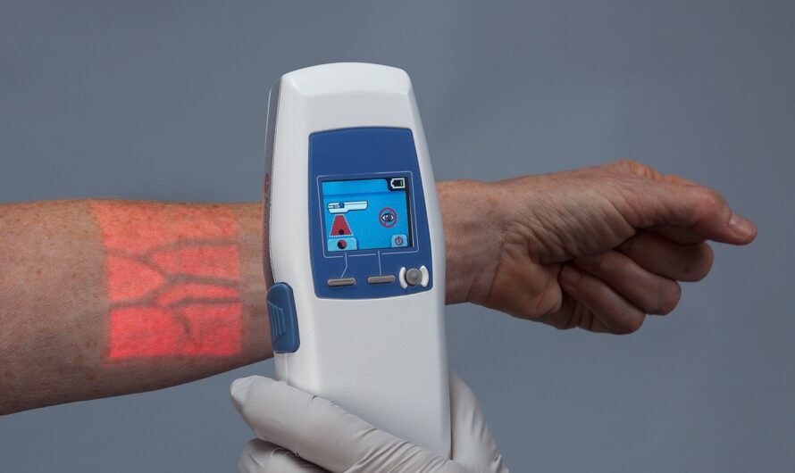 Global Vein Illumination Devices Market Is Expected to Be Flourished by Increasing Incidences of Chronic Vascular Diseases