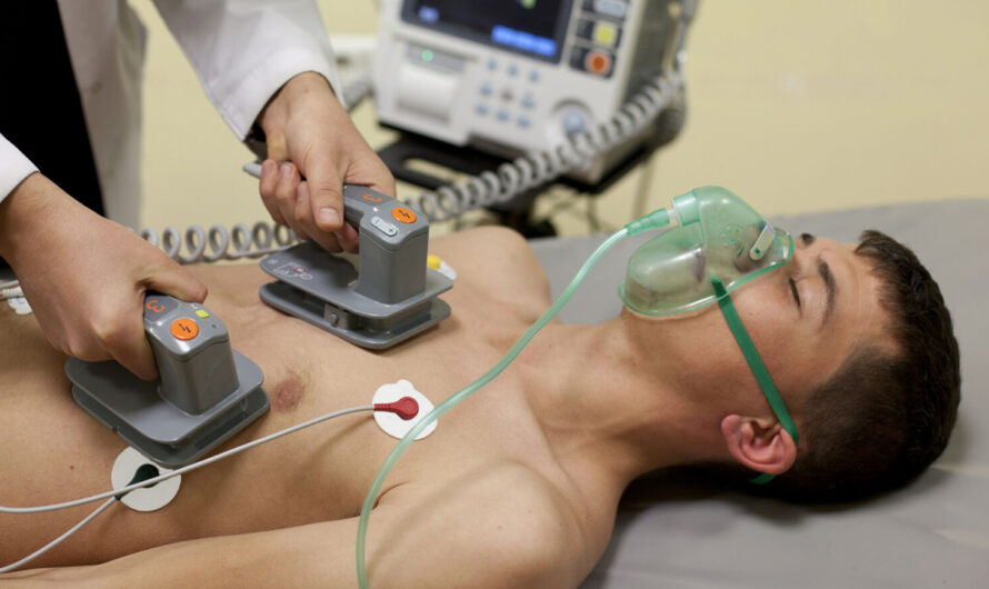 Cardiac Assist Devices: Revolutionizing Heart Failure Treatment