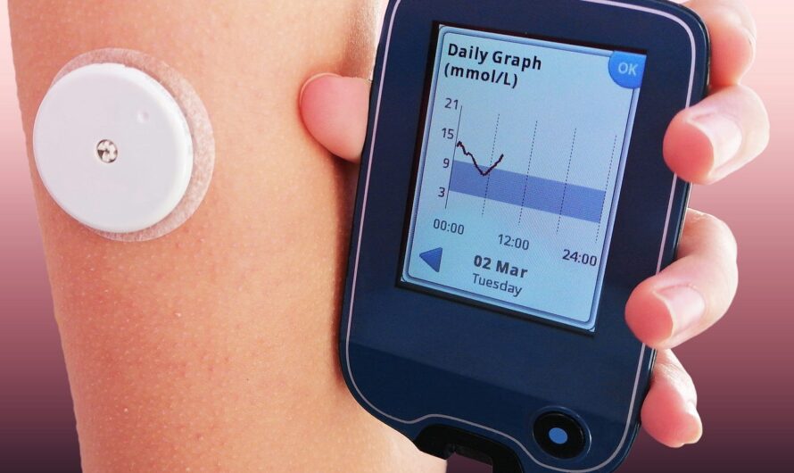 Continuous Glucose Monitoring Devices: Revolutionizing Diabetes Management