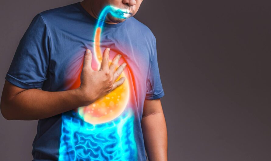 Treatment Options for Gastroesophageal Reflux Disease