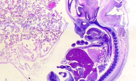 Placenta Cells Show Potential in Lowering Blood Pressure