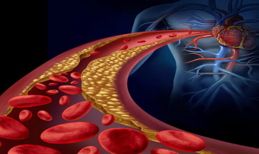 How the Liver’s Immune System Manages High Cholesterol Levels