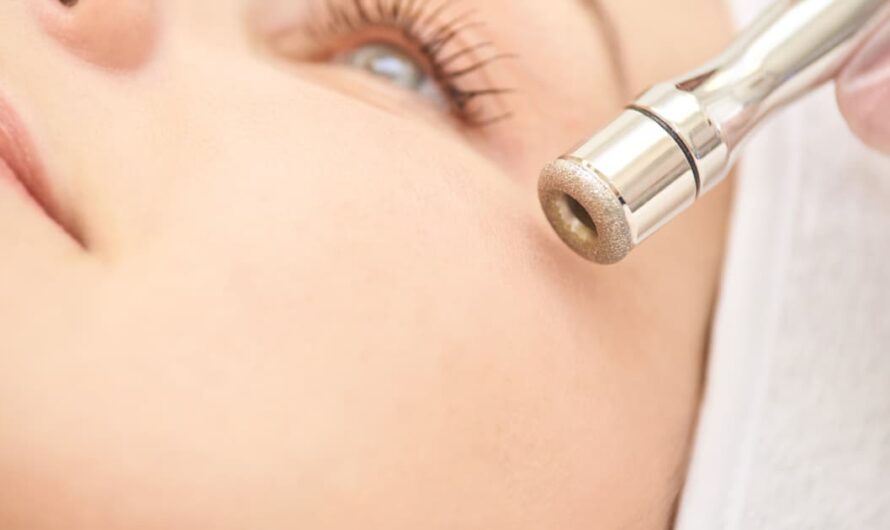 Understanding Microdermabrasion Devices: A Skin Exfoliation Treatment
