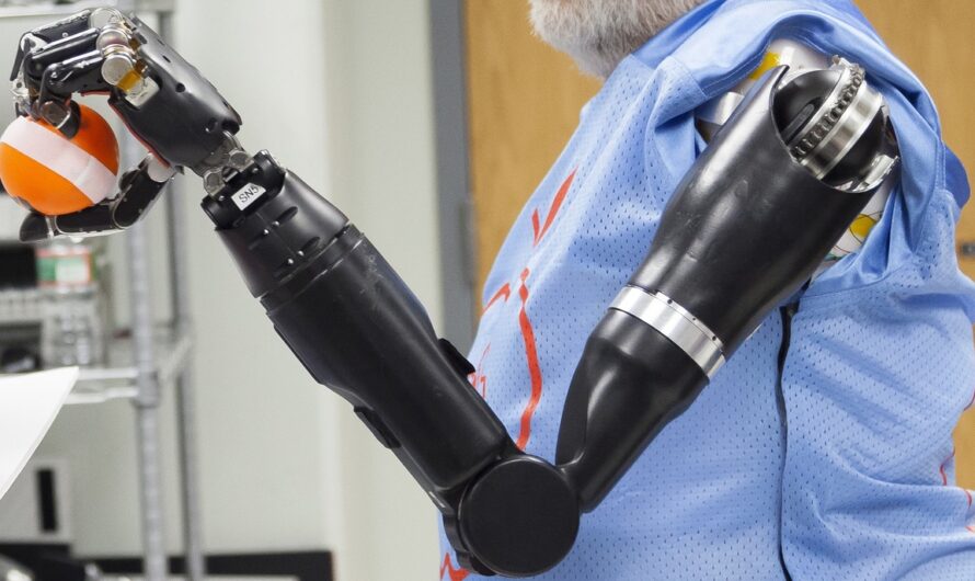 Growing Adoption of Bionic Limbs to Boost the Growth of Global Robotic Prosthetics Market