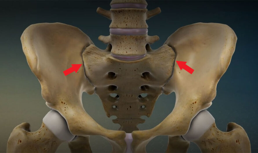 The Global Sacroiliac Joint Fusion Market Is Gaining Traction through Minimally Invasive Techniques Is the One Line Title