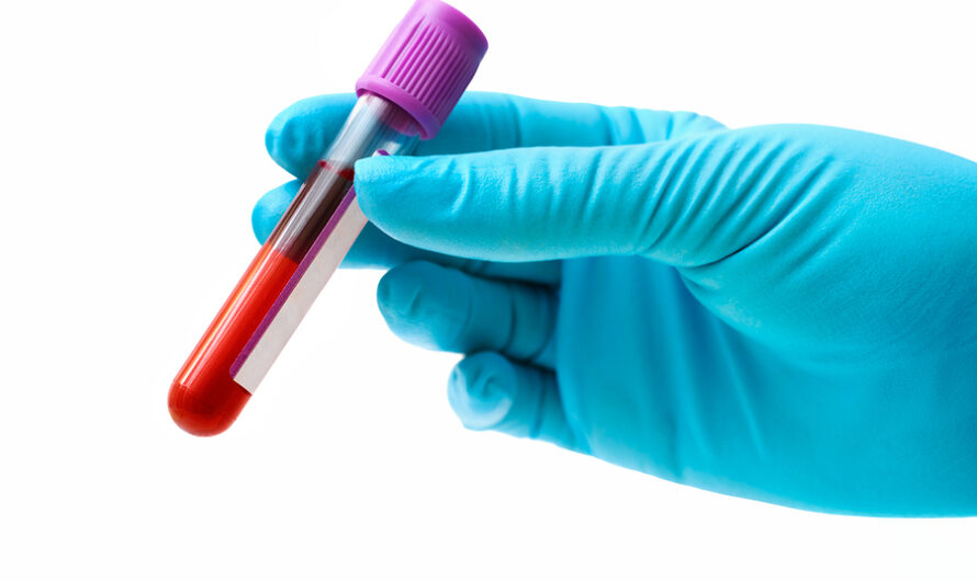 An Overview of Complete Blood Count Testing Devices