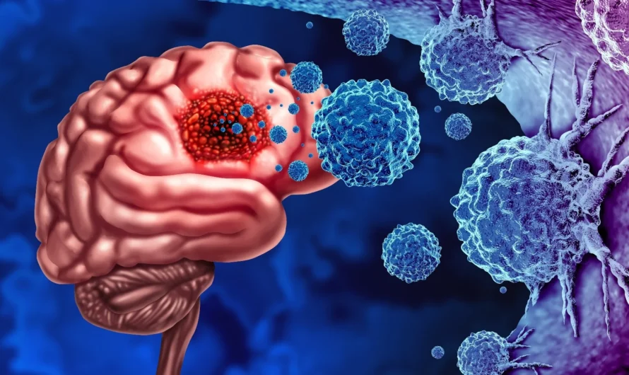Novel Genetic Mechanisms Discovered in Glioma Cells: A New Approach to Therapeutic Targeting