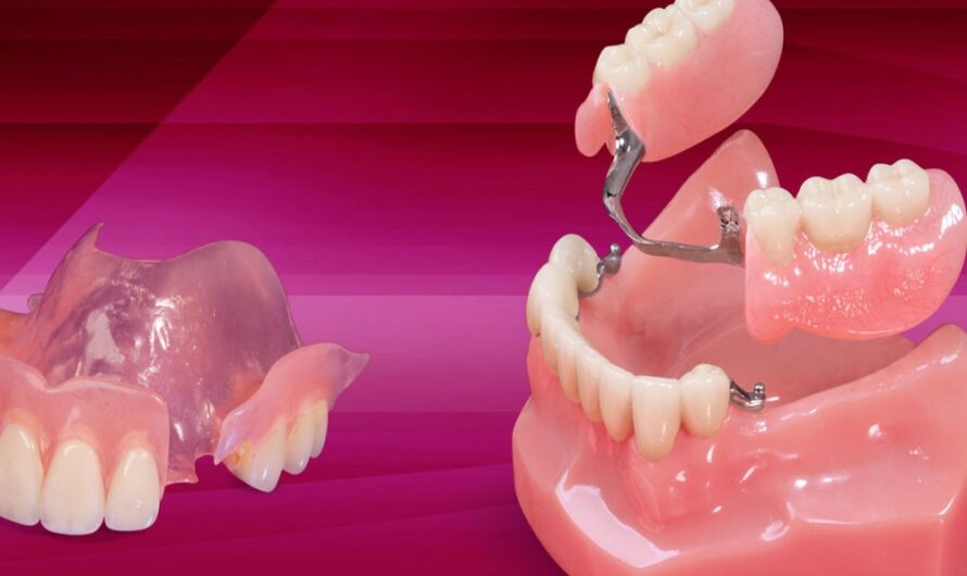 Prosthetic Full Arch Dentures: Restoring the Smile with Complete Dentures