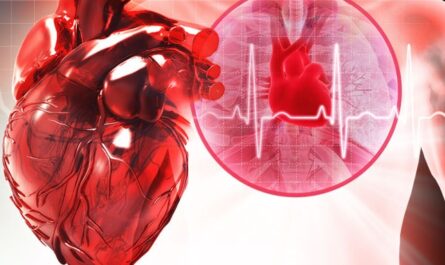 Cardiac Arrhythmia Monitoring Devices