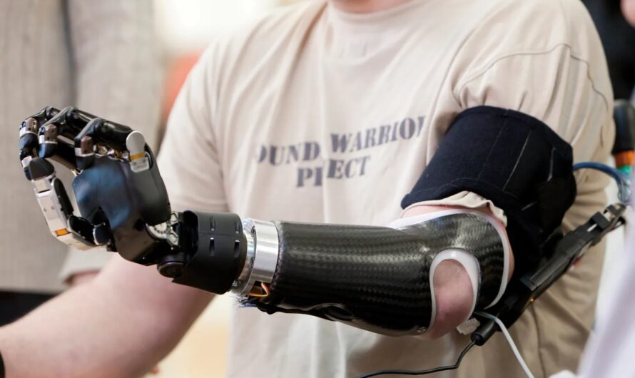 Robotic Prosthetics Market is leveraging Bionics and AI