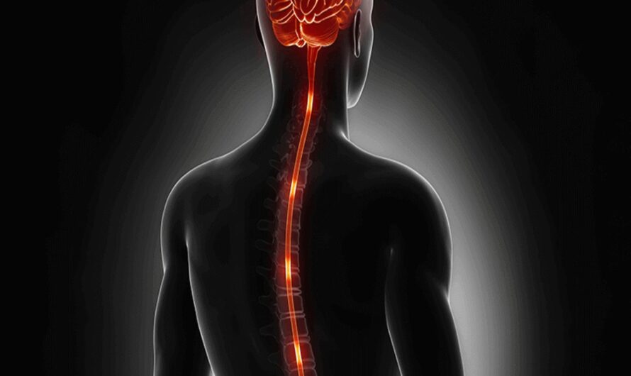 Understanding Sacral Nerve Stimulation as a Treatment Option