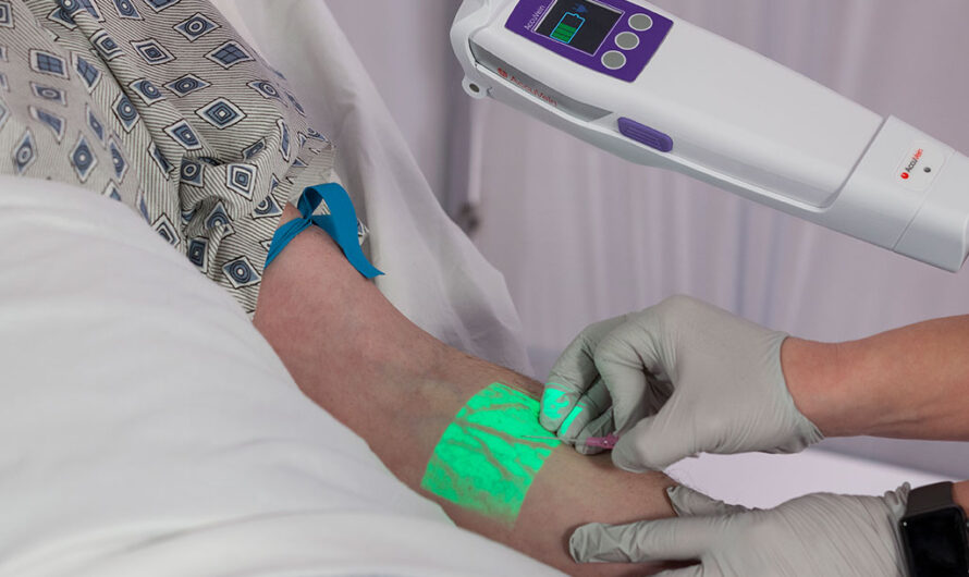 The Rising Demand for Non-invasive Vein Visualization is Driving the Global Vein Illumination Devices Market