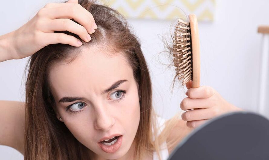 Hair Loss Treatment: Alternative and Conventional Methods to Stop Hair Fall