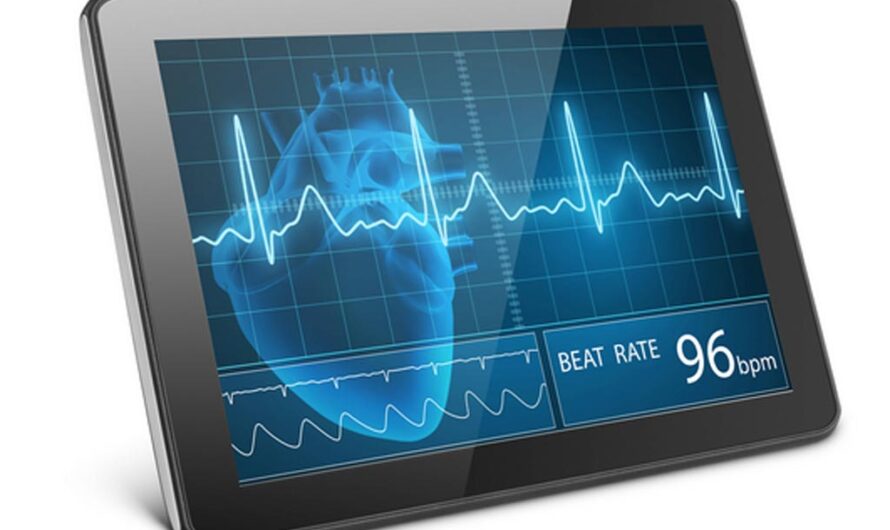 Mobile ECG Devices Industry: The Role of ECG Devices in Personalized Health Monitoring