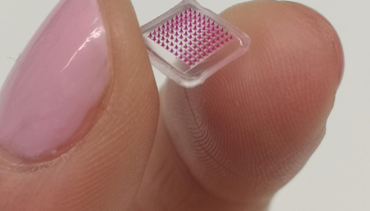New Microneedle Patch Technology Early Detection of Skin Cancer through Innovative Diagnostic Tool