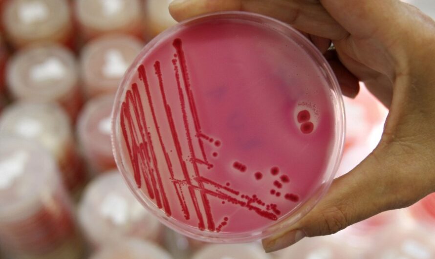 Salmonella Testing: Ensuring Food Safety Through Rigorous Microbiological Analysis