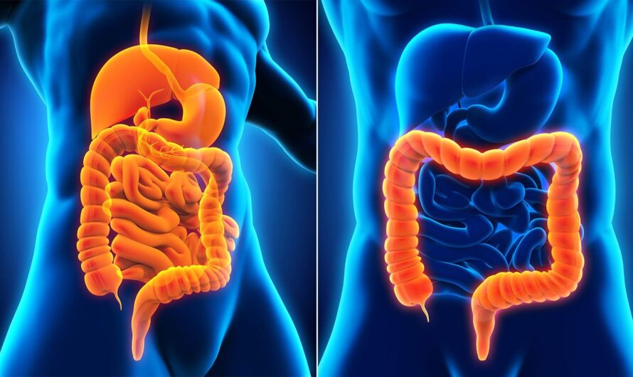 The United Kingdom Ulcerative Colitis Market Is Thriving on Innovation by Biologics