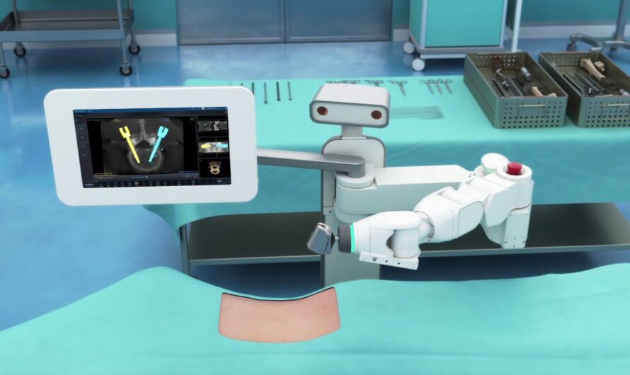 Spine Surgery Robots: How these Robots are Shaping the Future of Back Problems Treatment